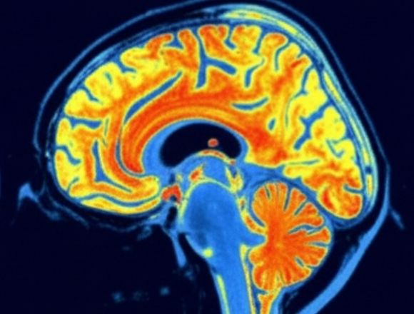 Gehirn-Scan nach 12 Wochen: erhöhte Aktivität